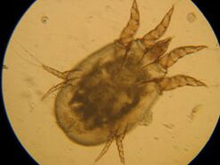 Note under a microscope