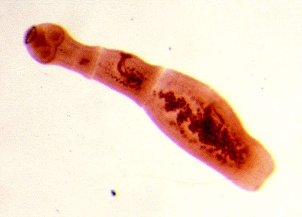 echinococcal